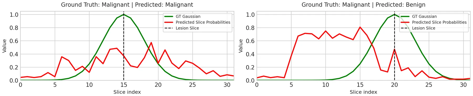 Two side-by-side slice probability plots over 32 slices: a correctly classified malignant case where the predicted probability peaks near the radiologist-annotated slice, and a misclassified malignant case where the activation is shifted away from it
