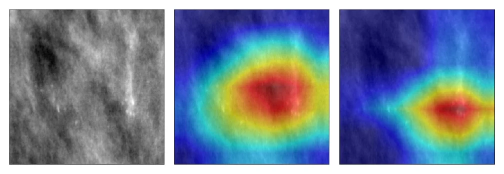 Three panels side by side: a grayscale mammography calcification patch, a Grad-CAM heatmap from the model trained without equalization showing a broad diffuse hot region, and a Grad-CAM heatmap from the model trained with random equalization at P equals 0.4 showing a tighter hot region over the bright calcification